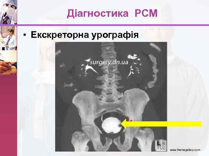 Діагностика РСМ • Екскреторна урографія www. themegallery. com 