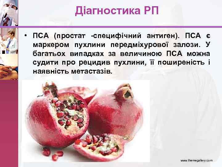 Діагностика РП • ПСА (простат -специфічний антиген). ПСА є маркером пухлини передміхурової залози. У