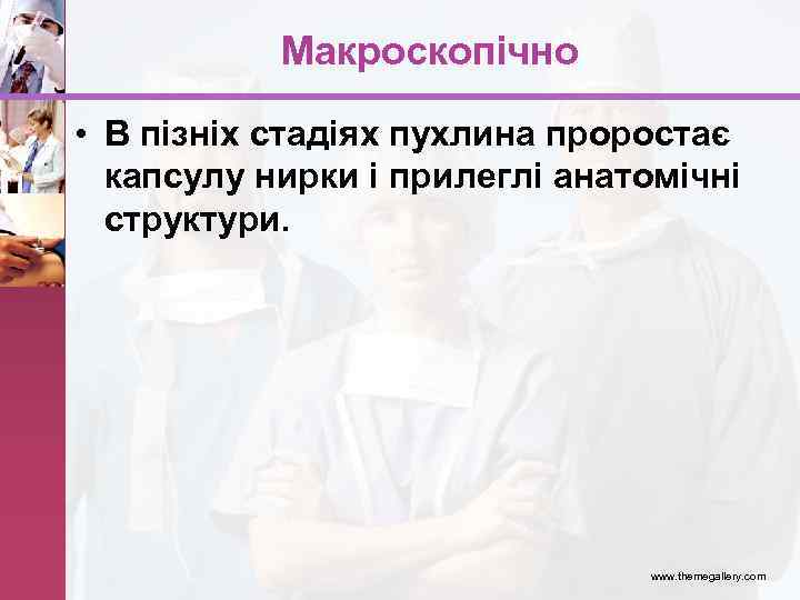 Макроскопічно • В пізніх стадіях пухлина проростає капсулу нирки і прилеглі анатомічні структури. www.