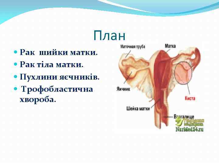 План Рак шийки матки. Рак тіла матки. Пухлини яєчників. Трофобластична хвороба. 