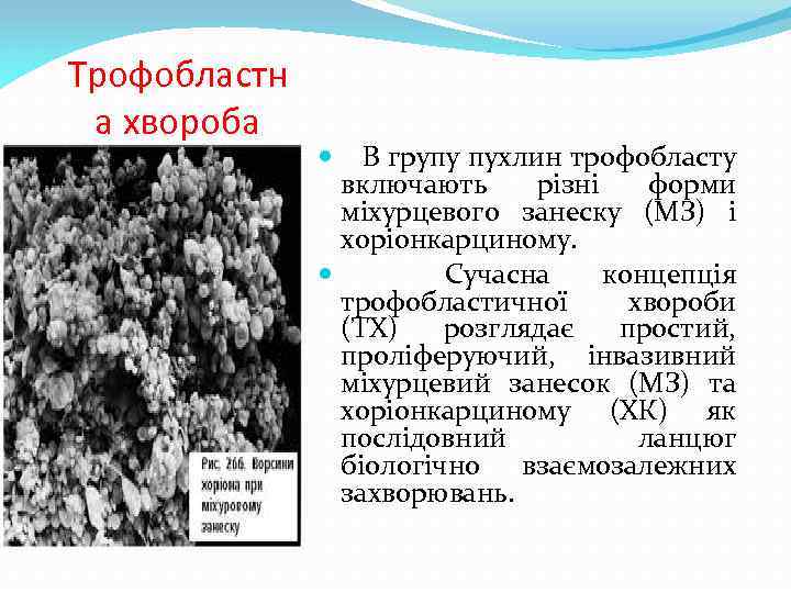 Трофобластн а хвороба В групу пухлин трофобласту включають різні форми міхурцевого занеску (МЗ) і