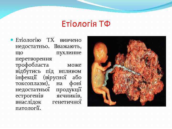 Етіологія ТФ Етіологію ТХ вивчено недостатньо. Вважають, що пухлинне перетворення трофобласта може відбутись під