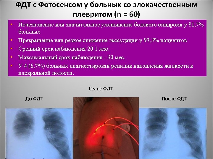 Фотодинамическая диагностика презентация