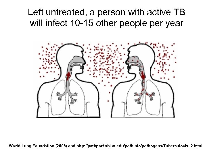 Left untreated, a person with active TB will infect 10 -15 other people per