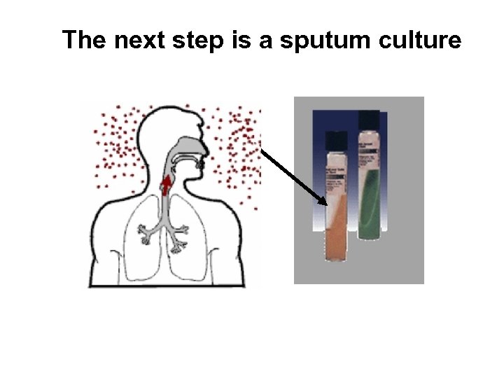 The next step is a sputum culture 