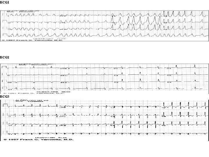 ECG 1 ECG 2 ECG 3 