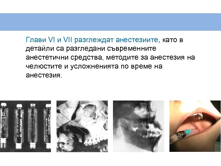 Глави VII разглеждат анестезиите, като в детайли са разгледани съвременните анестетични средства, методите за