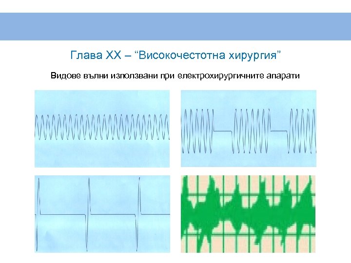 Глава XX – “Високочестотна хирургия” Видове вълни използвани при електрохирургичните апарати 