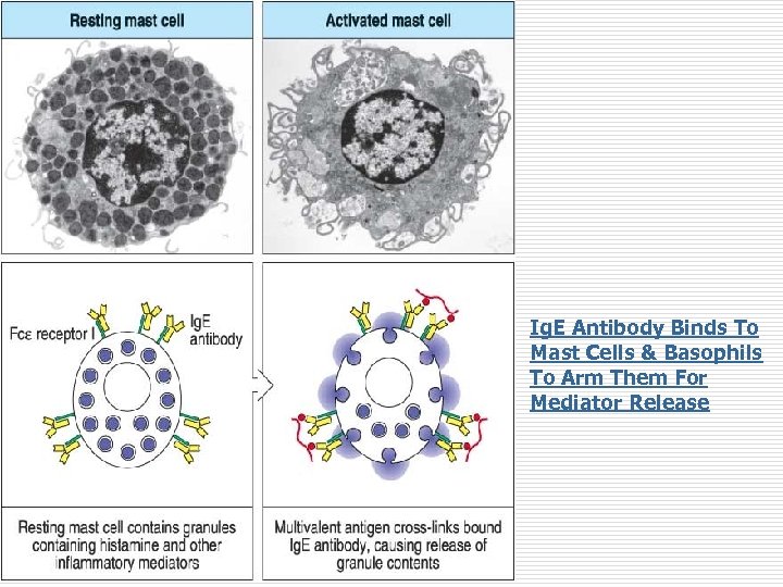 Ig. E Antibody Binds To Mast Cells & Basophils To Arm Them For Mediator