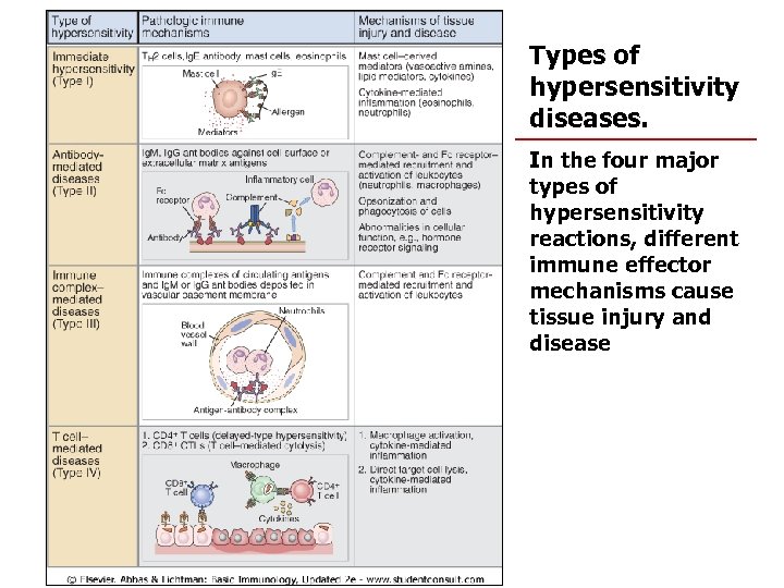 Types of hypersensitivity diseases. In the four major types of hypersensitivity reactions, different immune
