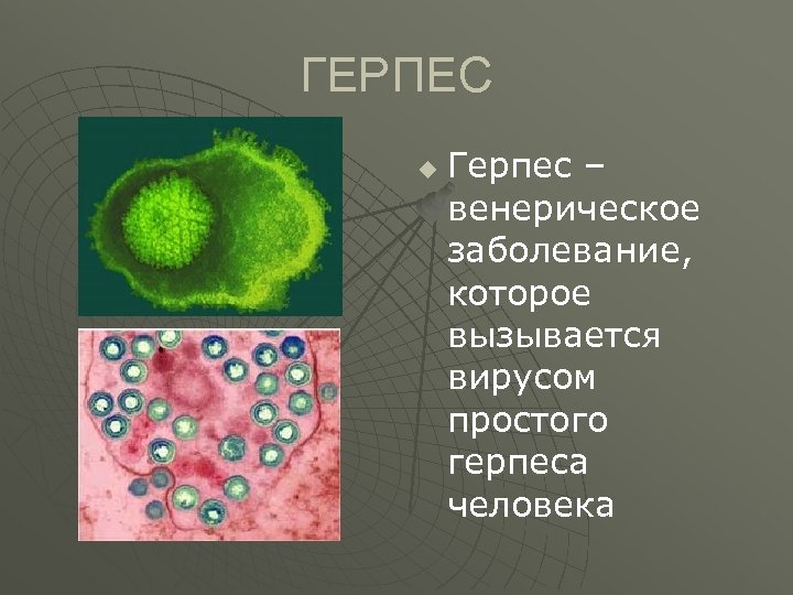 ГЕРПЕС u Герпес – венерическое заболевание, которое вызывается вирусом простого герпеса человека 