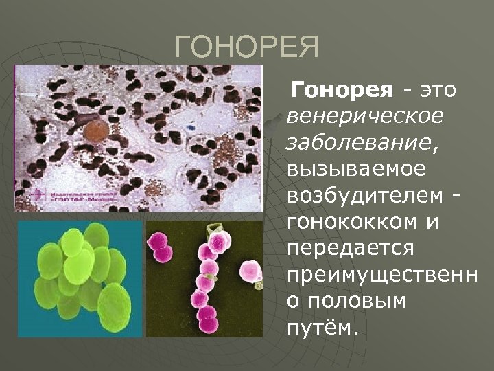 ГОНОРЕЯ Гонорея - это венерическое заболевание, вызываемое возбудителем гонококком и передается преимущественн о половым