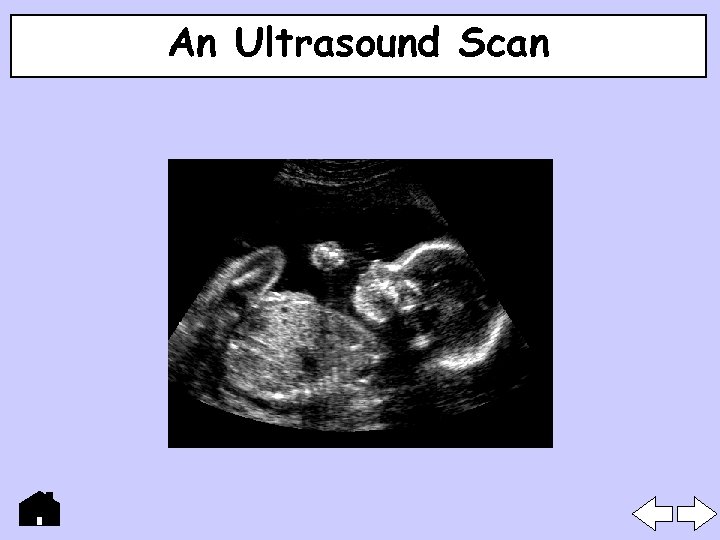 An Ultrasound Scan 