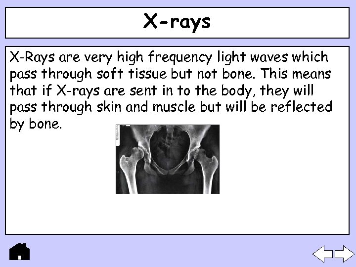 X-rays X-Rays are very high frequency light waves which pass through soft tissue but