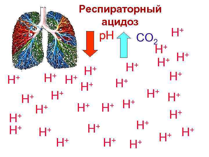 Респираторный ацидоз p. H H+ CO 2 H+ + + H H+ + H+