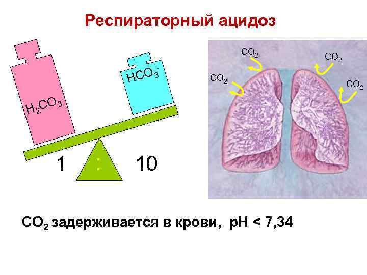 Респираторный ацидоз CO 2 CO 3 H CO 2 O 3 H 2 C