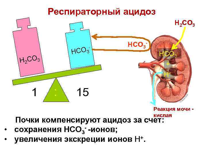 Респираторный ацидоз H 2 CO 3 O 3 HC H 2 CO 3 1