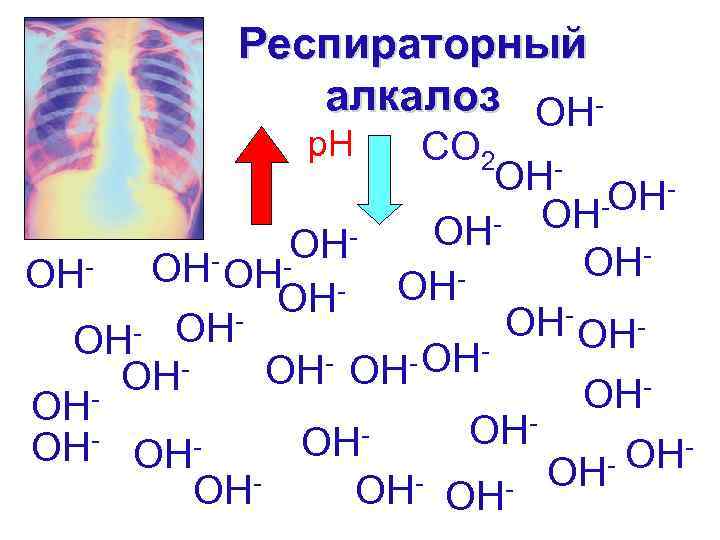 Респираторный алкалоз OHp. H CO 2 OH OHOH OH - OHOH OH OH- OHOH