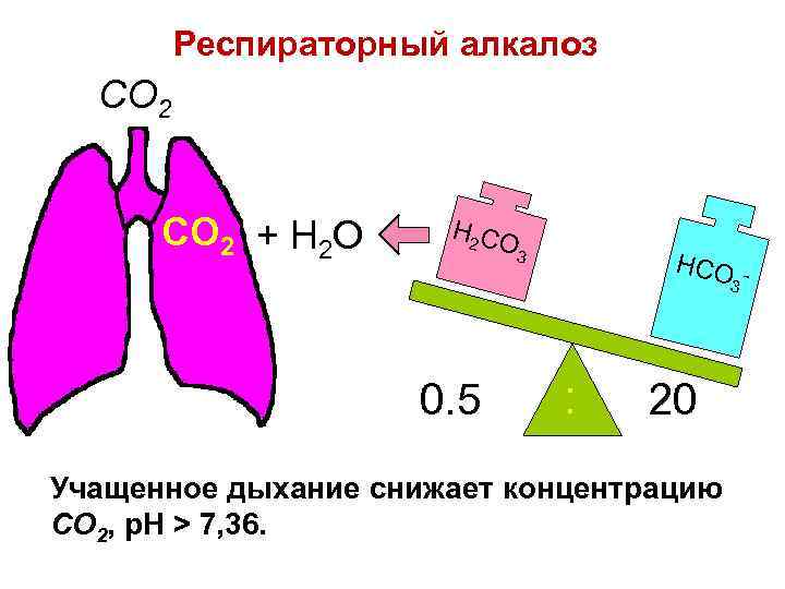 Респираторный алкалоз CO 2 + H 2 O H 2 CO 3 HCO 3