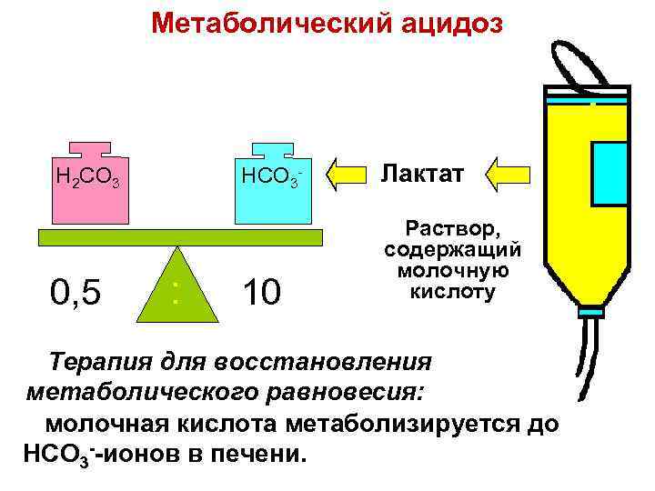 Метаболический ацидоз HCO 3 - H 2 CO 3 0, 5 : Лактат 10