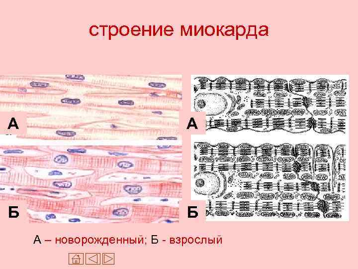 строение миокарда А А Б Б А – новорожденный; Б - взрослый 