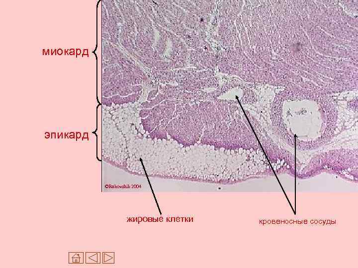 миокард эпикард ©Rakovshik 2004 жировые клетки кровеносные сосуды 