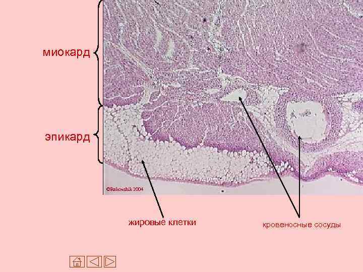Миокард гистология рисунок