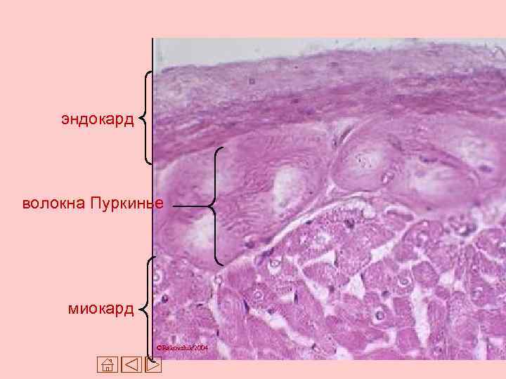 Эндокард рисунок гистология