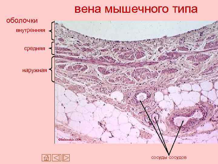 вена мышечного типа оболочки внутренняя средняя наружная ©Rakovshik 2004 сосуды сосудов 