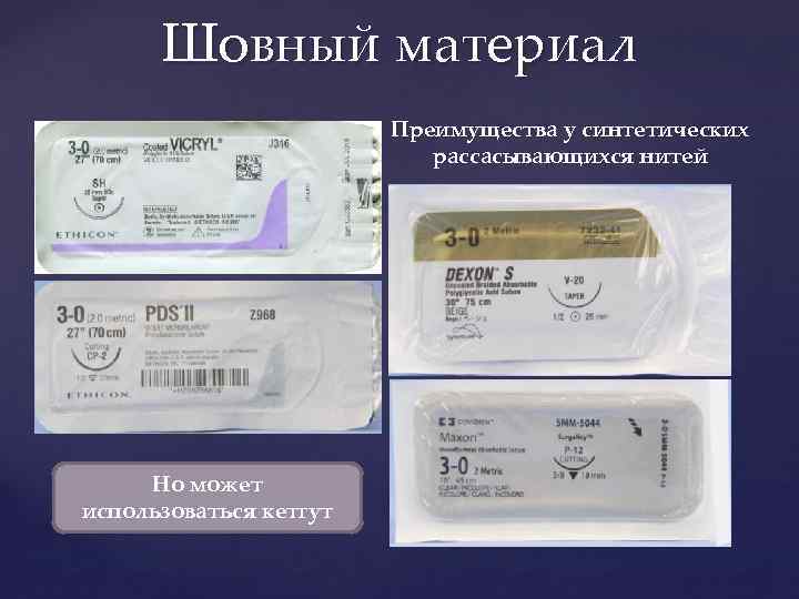 Шовный материал Преимущества у синтетических рассасывающихся нитей Но может использоваться кетгут 