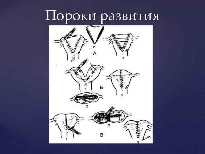 Пороки развития 