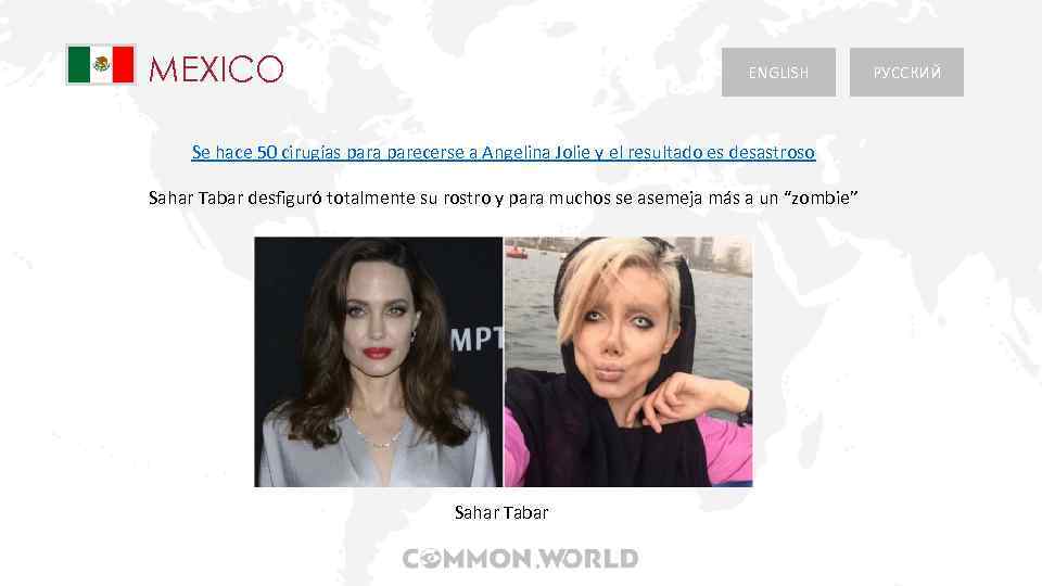 MEXICO ENGLISH Se hace 50 cirugías para parecerse a Angelina Jolie y el resultado