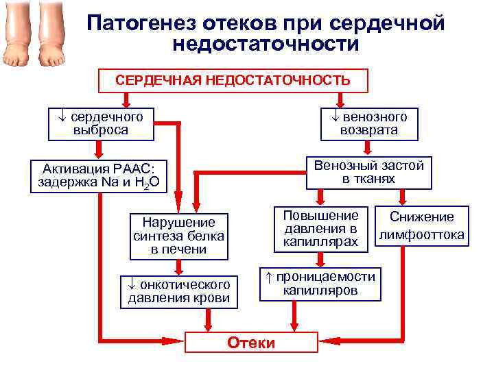 Патогенез отеков при сердечной недостаточности СЕРДЕЧНАЯ НЕДОСТАТОЧНОСТЬ сердечного выброса венозного возврата Активация РААС: задержка