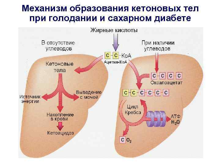 Механизм образования кетоновых тел при голодании и сахарном диабете 