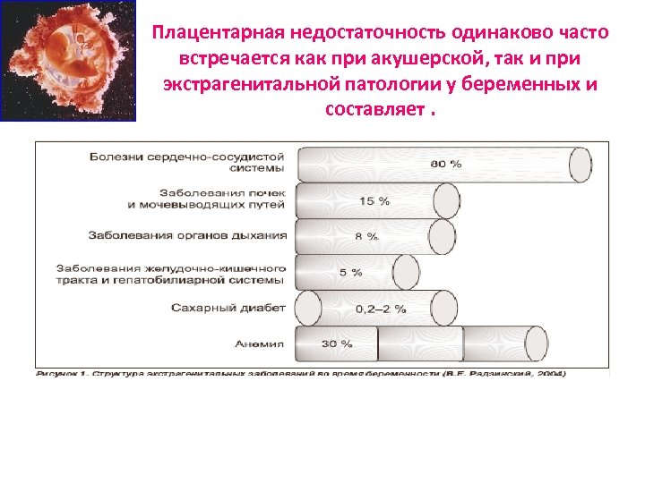 Плацентарная недостаточность одинаково часто встречается как при акушерской, так и при экстрагенитальной патологии у