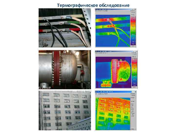 Термографическое обследование 