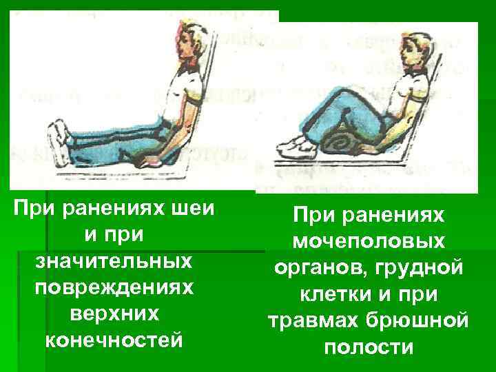 При ранениях шеи и при значительных повреждениях верхних конечностей При ранениях мочеполовых органов, грудной