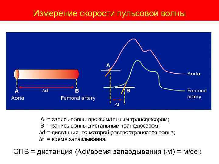 Измерение скорости пульсовой волны А = запись волны проксимальным трансдюсером; В = запись волны