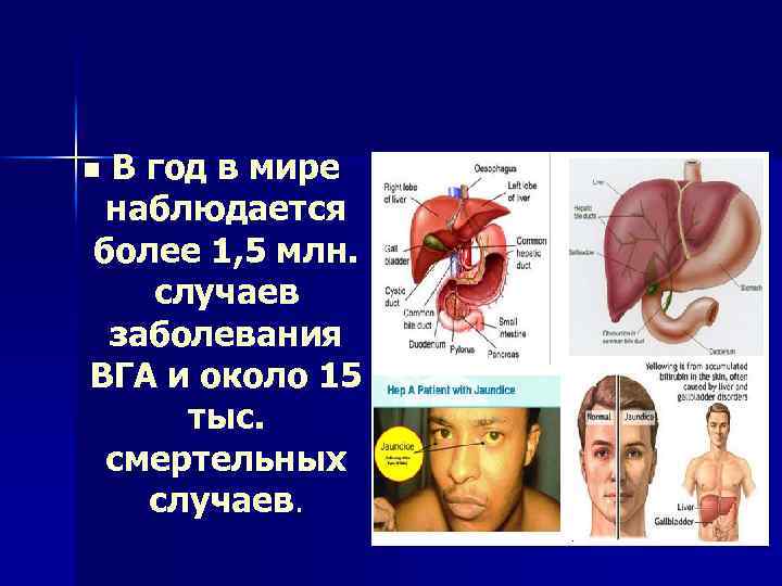 В год в мире наблюдается более 1, 5 млн. случаев заболевания ВГА и около