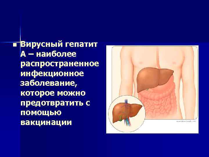 n Вирусный гепатит А – наиболее распространенное инфекционное заболевание, которое можно предотвратить с помощью