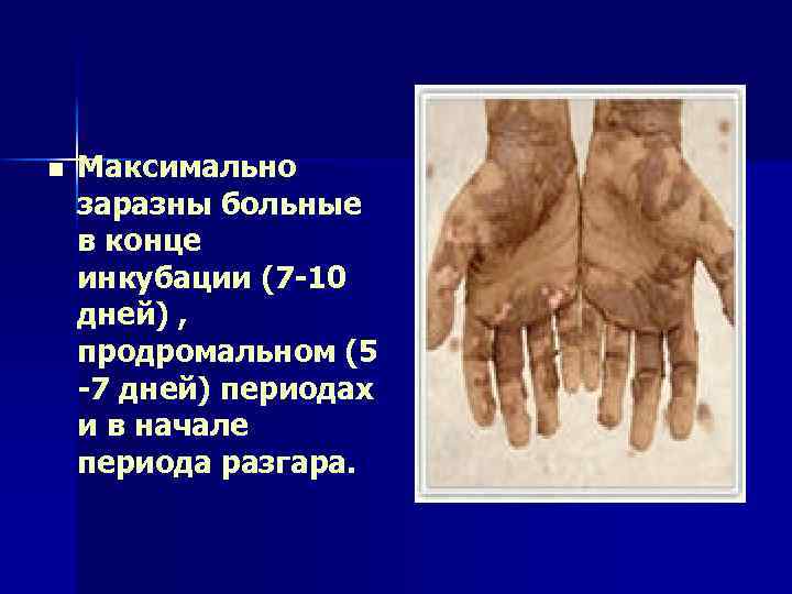 n Максимально заразны больные в конце инкубации (7 -10 дней) , продромальном (5 -7