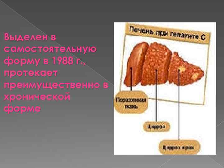 Выделен в самостоятельную форму в 1988 г. , протекает преимущественно в хронической форме 