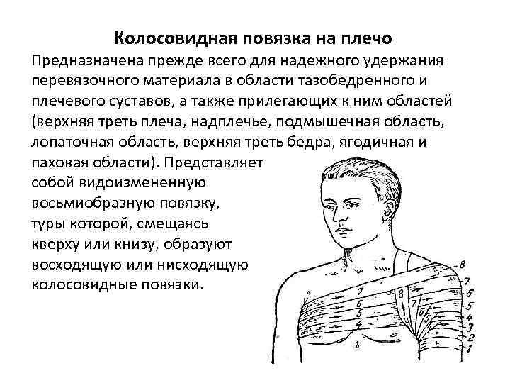 Колосовидная повязка на плечо Предназначена прежде всего для надежного удержания перевязочного материала в области