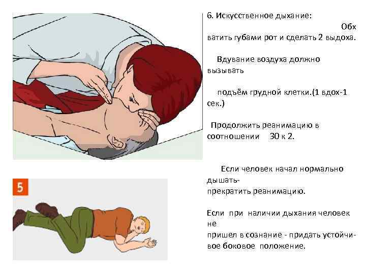 Искусственное дыхание прикольные картинки