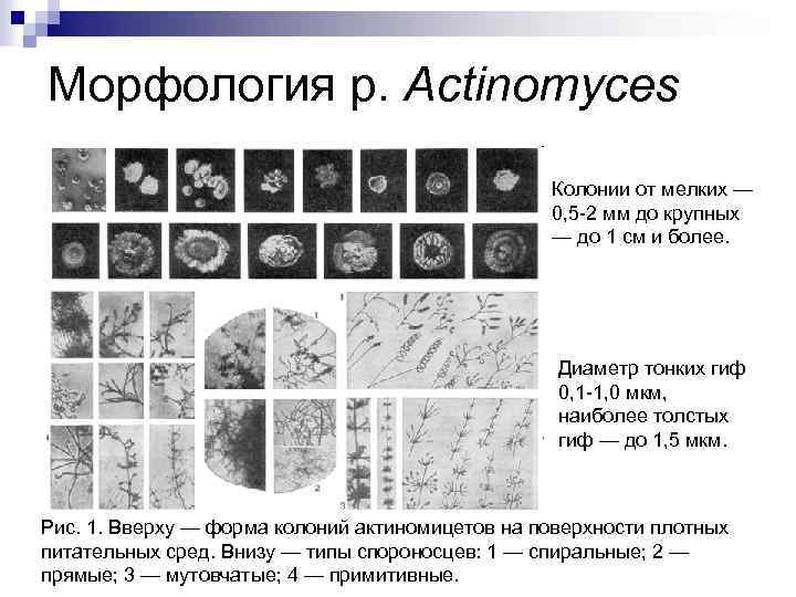 Морфология р. Actinomyces Колонии от мелких — 0, 5 -2 мм до крупных —