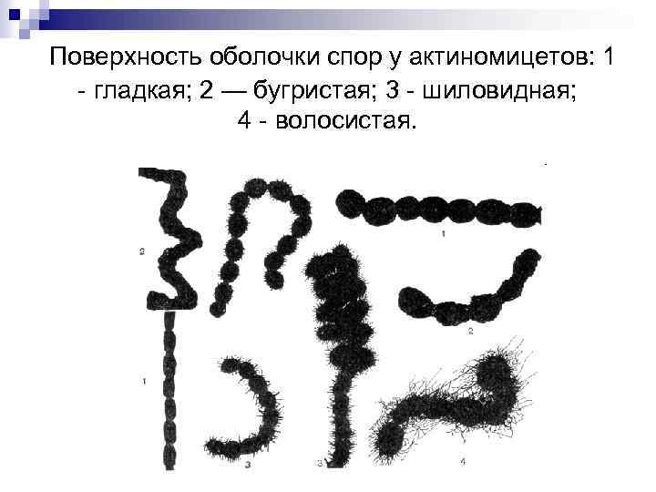 Поверхность оболочки спор у актиномицетов: 1 - гладкая; 2 — бугристая; 3 - шиловидная;