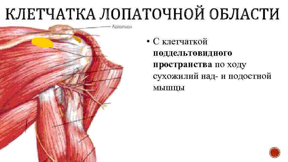  • С клетчаткой поддельтовидного пространства по ходу сухожилий над- и подостной мышцы 