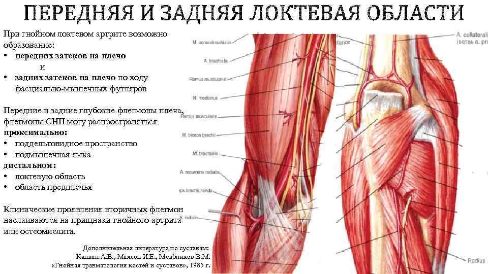 При гнойном локтевом артрите возможно образование: • передних затеков на плечо и • задних