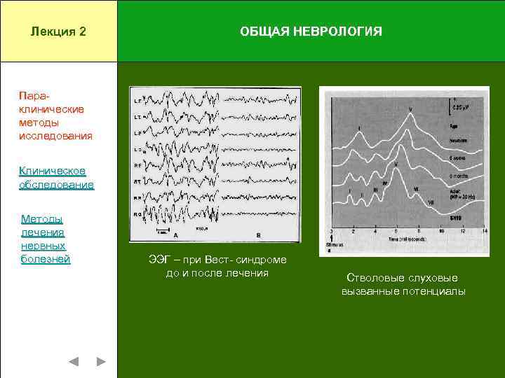 Лекция 2 ОБЩАЯ НЕВРОЛОГИЯ Параклинические методы исследования Клиническое обследование Методы лечения нервных болезней ЭЭГ