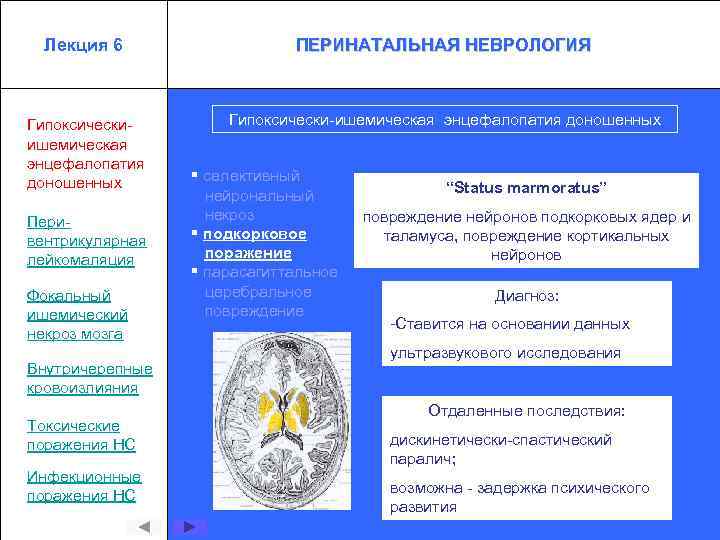 Лекция 6 ПЕРИНАТАЛЬНАЯ НЕВРОЛОГИЯ Гипоксическиишемическая энцефалопатия доношенных Гипоксически-ишемическая энцефалопатия доношенных Перивентрикулярная лейкомаляция Фокальный ишемический